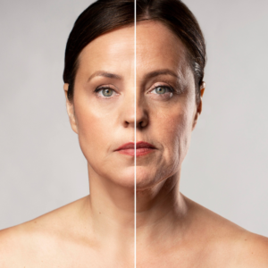 Lifting: Elevando sua Beleza Natural a Novas Alturas